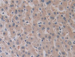 ADAM17 Antibody in Immunohistochemistry (Paraffin) (IHC (P))