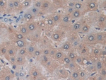 ADAM17 Antibody in Immunohistochemistry (Paraffin) (IHC (P))