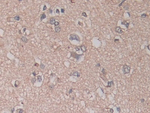 ADAM17 Antibody in Immunohistochemistry (Paraffin) (IHC (P))