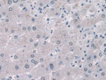FABP1 Antibody in Immunohistochemistry (Paraffin) (IHC (P))