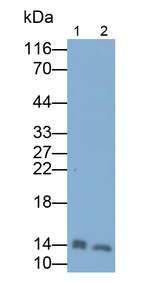 FABP1 Antibody in Western Blot (WB)