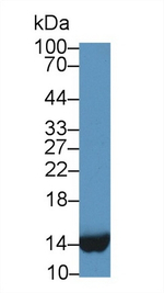 FABP1 Antibody in Western Blot (WB)