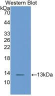 FABP1 Antibody in Western Blot (WB)