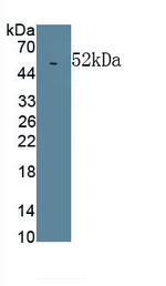 LBP Antibody in Western Blot (WB)