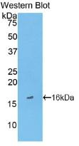 FABP3 Antibody in Western Blot (WB)