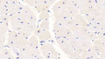 S100A1 Antibody in Immunohistochemistry (Paraffin) (IHC (P))