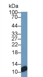 S100A1 Antibody in Western Blot (WB)