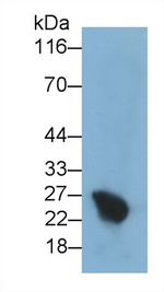 CSH1 Antibody in Western Blot (WB)