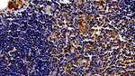 STAT3 Antibody in Immunohistochemistry (Paraffin) (IHC (P))