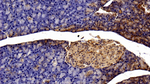 STAT3 Antibody in Immunohistochemistry (Paraffin) (IHC (P))