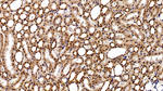STAT3 Antibody in Immunohistochemistry (Paraffin) (IHC (P))