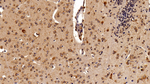 STAT3 Antibody in Immunohistochemistry (Paraffin) (IHC (P))