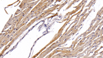 STAT3 Monoclonal Antibody (D11)