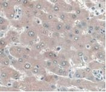 UCP2 Antibody in Immunohistochemistry (Paraffin) (IHC (P))