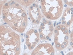 UCP2 Antibody in Immunohistochemistry (Paraffin) (IHC (P))