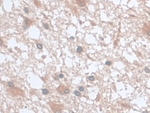 UCP2 Antibody in Immunohistochemistry (Paraffin) (IHC (P))
