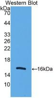 UCP2 Antibody in Western Blot (WB)