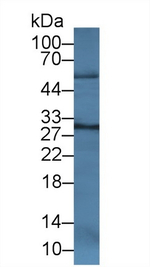 Cathepsin K Antibody in Western Blot (WB)