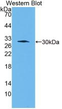 Cathepsin K Antibody in Western Blot (WB)