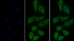 tPA Monoclonal Antibody (K17)