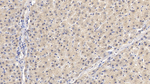 SMAD3 Antibody in Immunohistochemistry (Paraffin) (IHC (P))