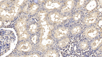 SMAD3 Antibody in Immunohistochemistry (Paraffin) (IHC (P))