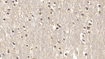 SMAD3 Antibody in Immunohistochemistry (Paraffin) (IHC (P))