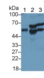 SMAD3 Antibody in Western Blot (WB)
