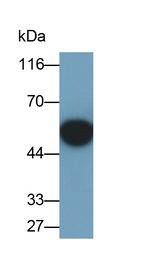 SMAD3 Antibody in Western Blot (WB)
