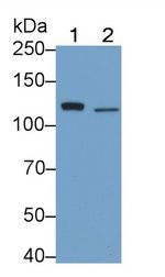 TLR5 Antibody in Western Blot (WB)