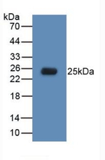 TLR5 Antibody in Western Blot (WB)