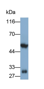 INHA Antibody in Western Blot (WB)
