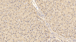 FAP Antibody in Immunohistochemistry (Paraffin) (IHC (P))