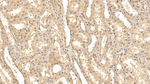 FAP Antibody in Immunohistochemistry (Paraffin) (IHC (P))