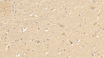 FAP Antibody in Immunohistochemistry (Paraffin) (IHC (P))