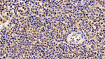 Cofilin Antibody in Immunohistochemistry (Paraffin) (IHC (P))