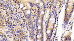 Cofilin Antibody in Immunohistochemistry (Paraffin) (IHC (P))