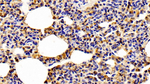 Cofilin Antibody in Immunohistochemistry (Paraffin) (IHC (P))