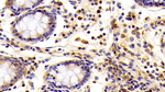 Cofilin Antibody in Immunohistochemistry (Paraffin) (IHC (P))