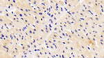 Cofilin Antibody in Immunohistochemistry (Paraffin) (IHC (P))