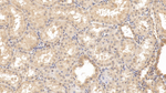 RAB5A Antibody in Immunohistochemistry (Paraffin) (IHC (P))