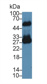FKBP7 Antibody in Western Blot (WB)