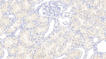 RHD Monoclonal Antibody (C2)