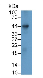 RHD Antibody in Western Blot (WB)
