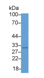 Syntenin 2 Antibody in Western Blot (WB)