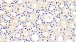 KIM-1 Monoclonal Antibody (C11)