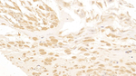 CK1 delta Antibody in Immunohistochemistry (Paraffin) (IHC (P))