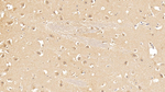 CK1 delta Monoclonal Antibody (C1)