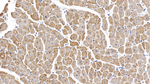 IL-6 Antibody in Immunohistochemistry (Paraffin) (IHC (P))