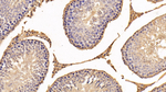 S100A10 Antibody in Immunohistochemistry (Paraffin) (IHC (P))